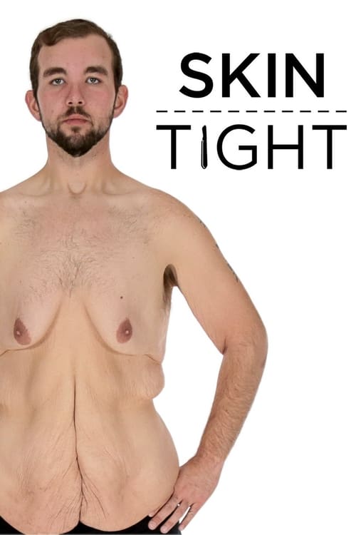 Poster della serie My 600-lb Life: Skin Tight