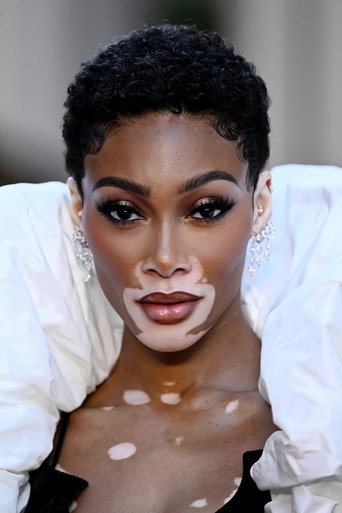 Immagine di Winnie Harlow